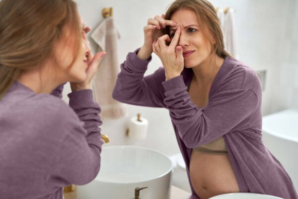 Die besten Tipps gegen unreine Haut in der Schwangerschaft - Die besten Tipps gegen unreine Haut in der Schwangerschaft