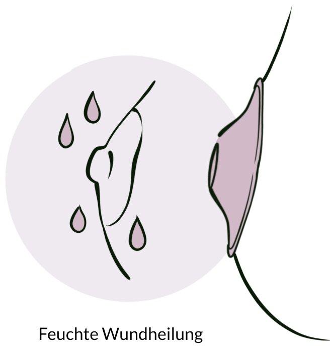 Schutz der feuchten Umgebung Abbildung