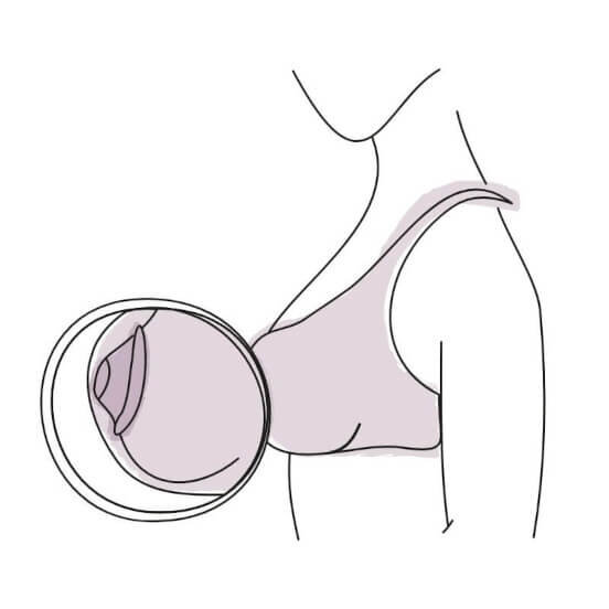Protection of painful and sensitive nipples illustration