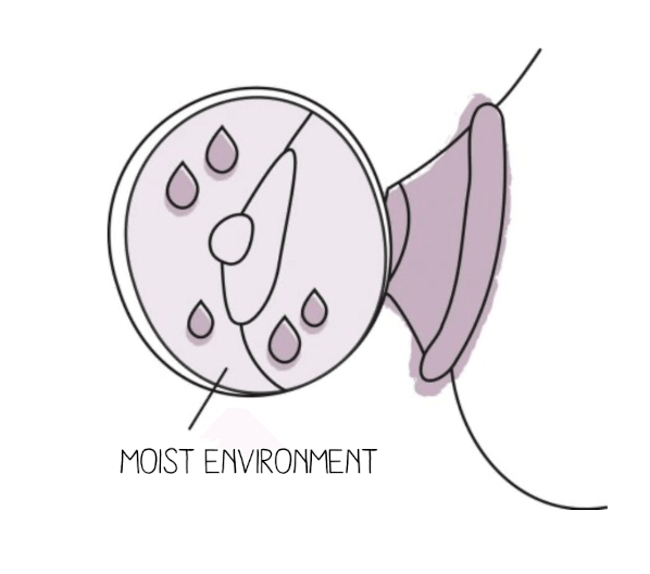 Protection of the moist environment illustration