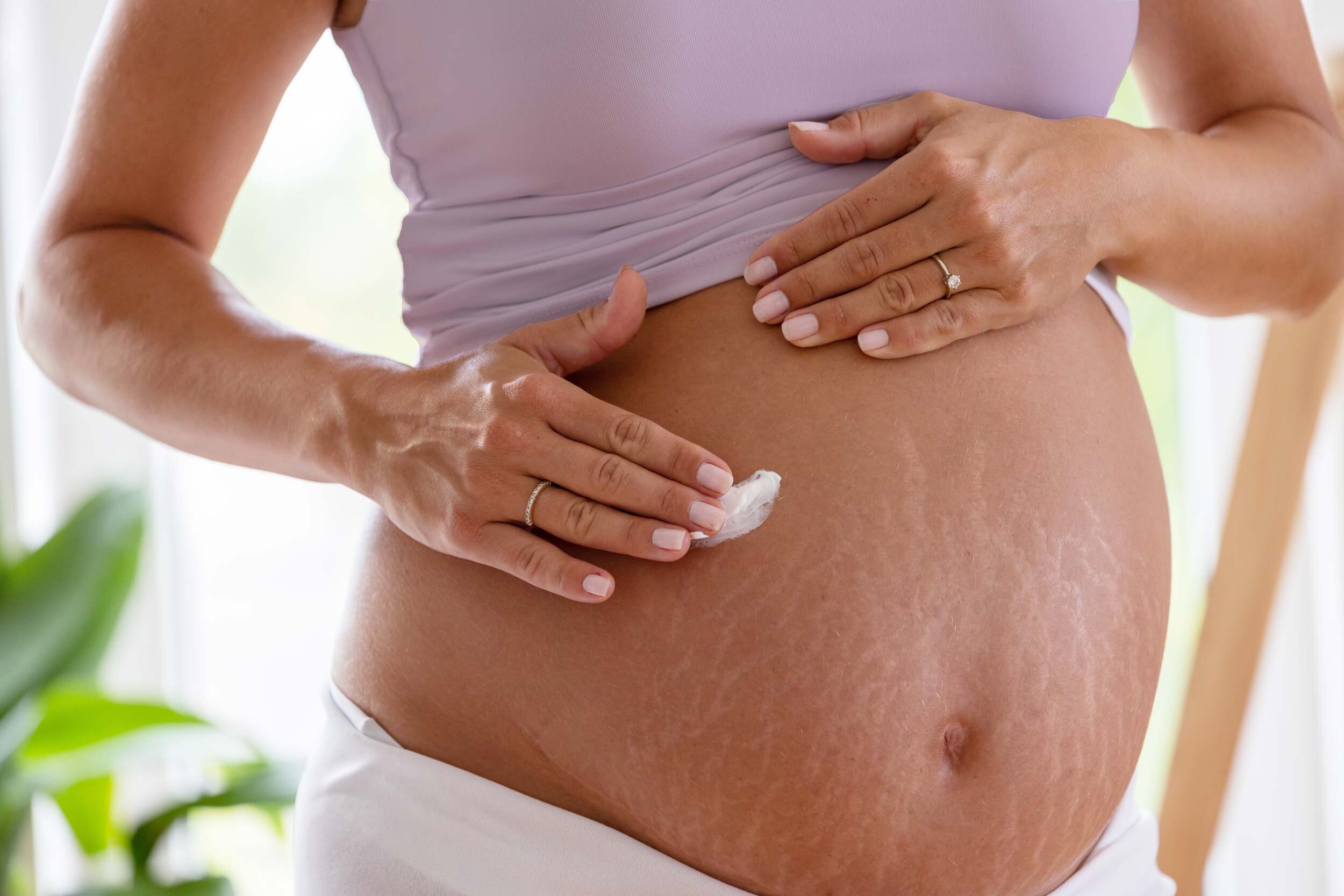 Frau mit Schwangerschaftsstreifen cremt ihren Bauch ein.