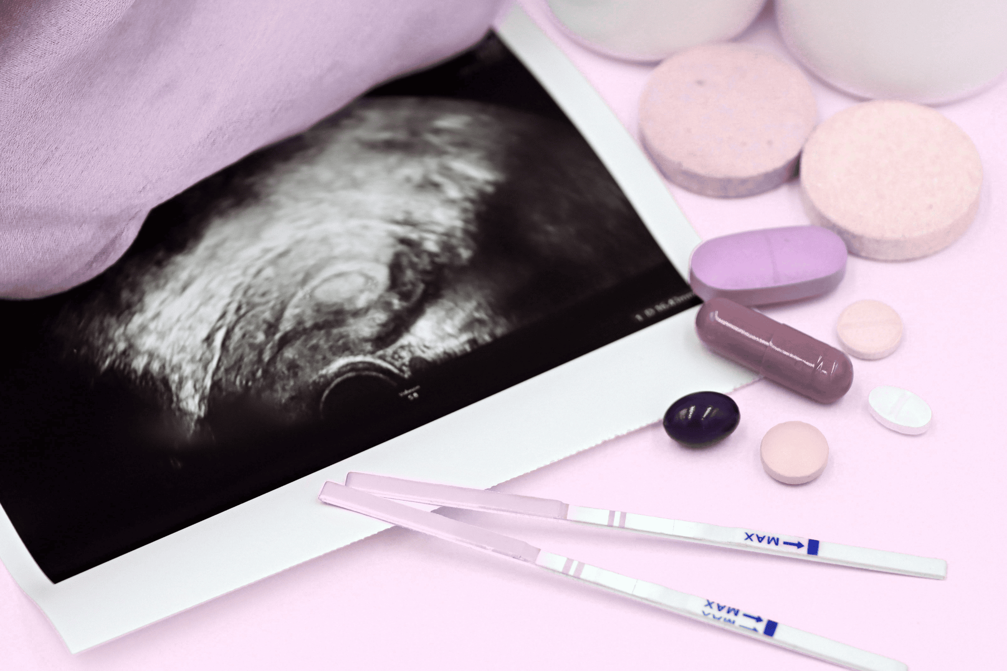 Ultraschalbild und Tabletten in Nahaufnahme